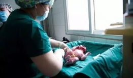 剖宫产视频,直观了解现代产科技术